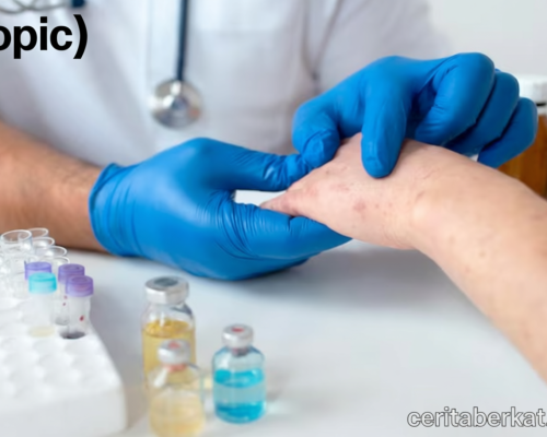 Sempat Muncul 17 Kasus – Dinkes Kota Malang Pastikan Tren Campak Kini Melandai